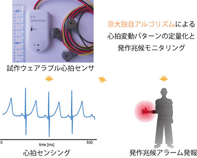 心拍変動モニタリングを用いたてんかん発作兆候検知デバイス
